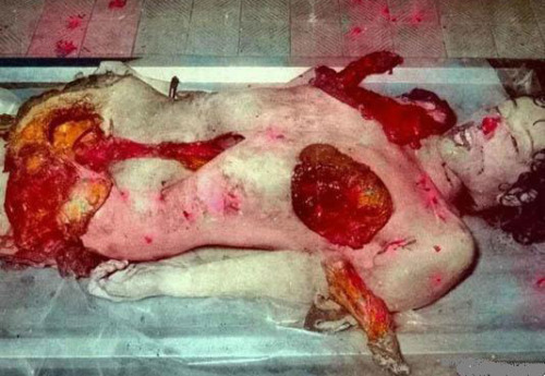 松山協和病院口コミ